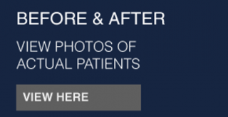 before & after | view photos of actual patients | view here